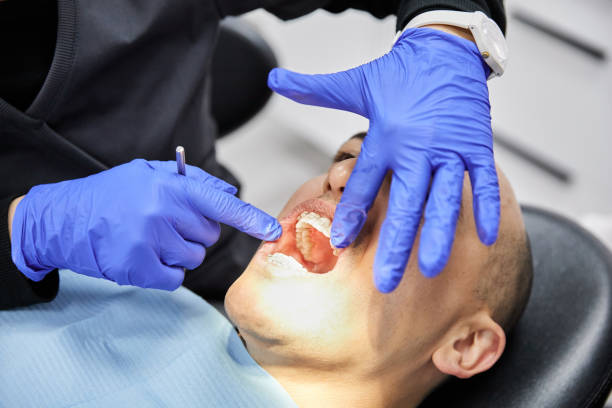 Best Emergency Treatment for Dental Infections or Abscesses in Robbins, IL